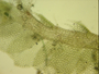 Chiloscyphus  , erosus, , Cell wall anatomy and oil bodies